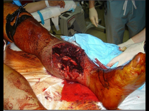 Basic Trauma Management Course