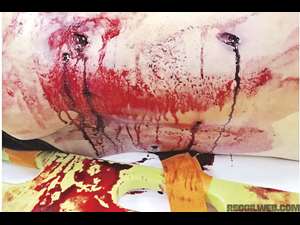 Basic Trauma Management Course