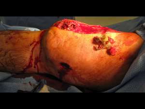 Basic Trauma Management Course